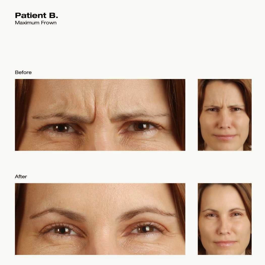 Bethany Facial Center