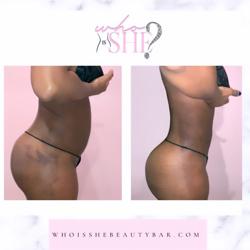 Who Is She Beauty Bar Lymphatic Massages And Post Op Care