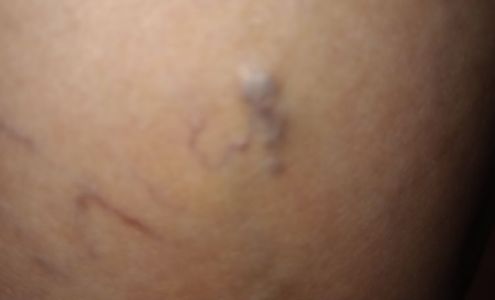 OSF MarketPlace - OSF Saint Anthony Rockford