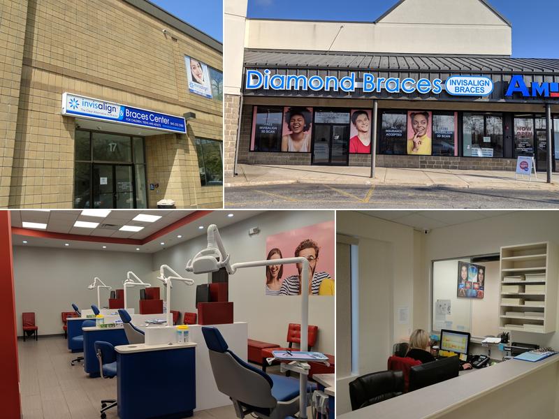 Diamond Braces Orthodontist: Braces & Invisalign