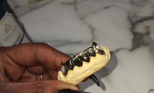 GS Gold Teeth