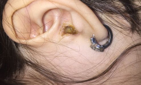 Home Oxygen Medical Equipment Kemmerer