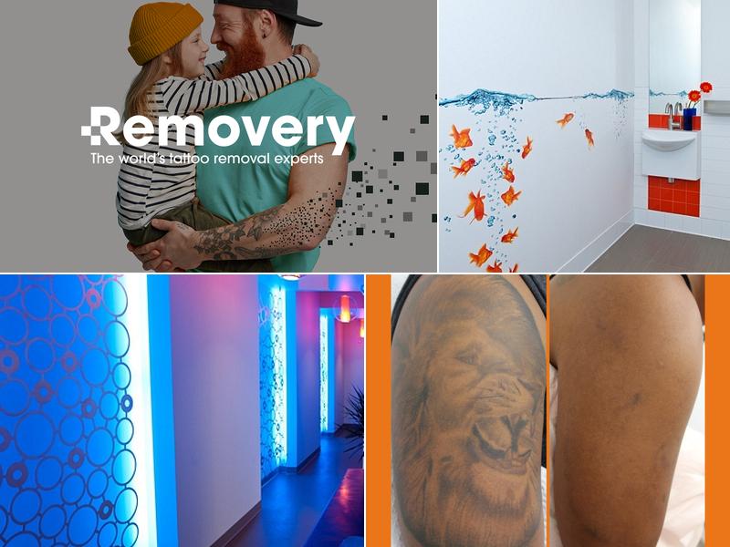 Removery Tattoo Removal & Fading