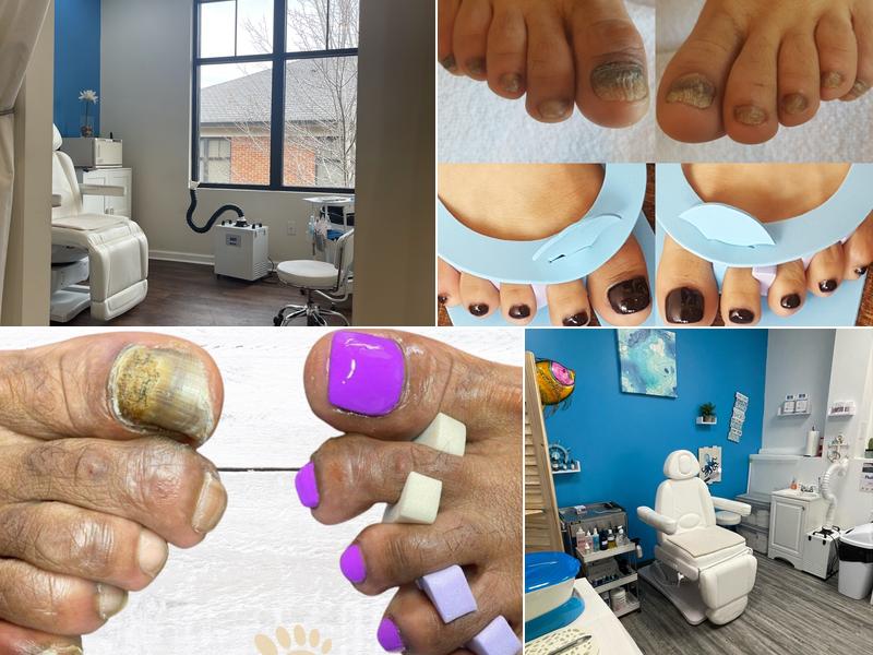 NuFeet Medical Pedicures