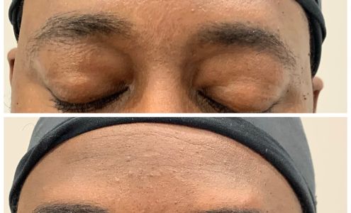 Tri-County Laser Center