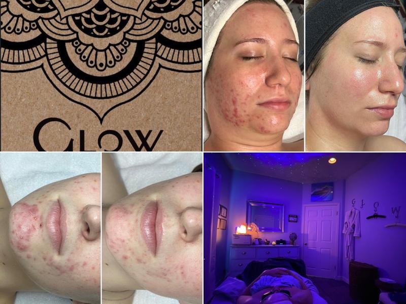 Glow Advanced Skin and Body Care