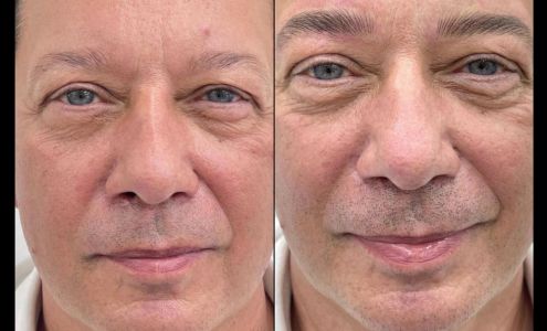 Burbank Microblading