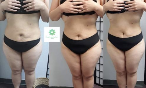 Natural Wellness & Beauty LLC | Lymphatic Drainage Post Op| Massage