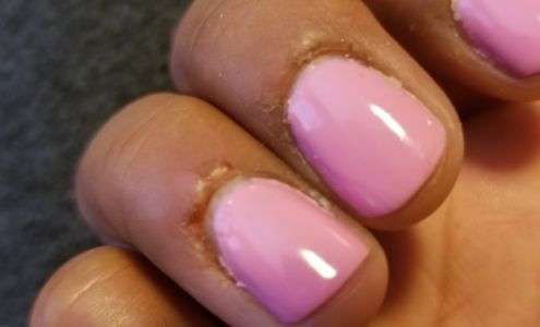 Emergency Ignition Repair