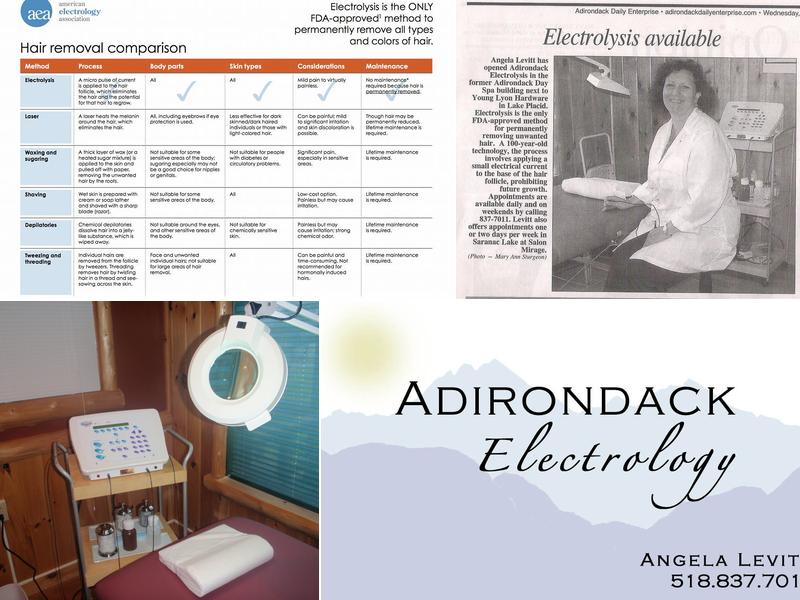 Adirondack Electrology