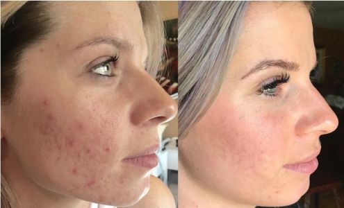 Lisia's Electrolysis & Laser/Body Contouring By Katie