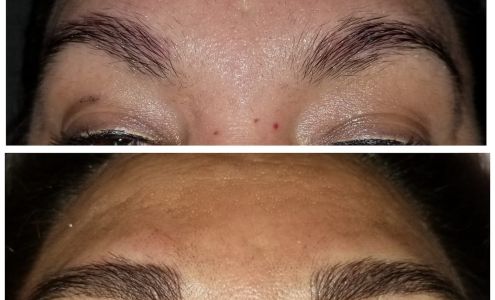 Metamorphosis Clinical and Cosmetic Tattoos