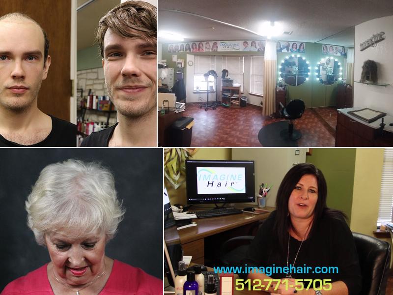 Imagine Hair Replacement