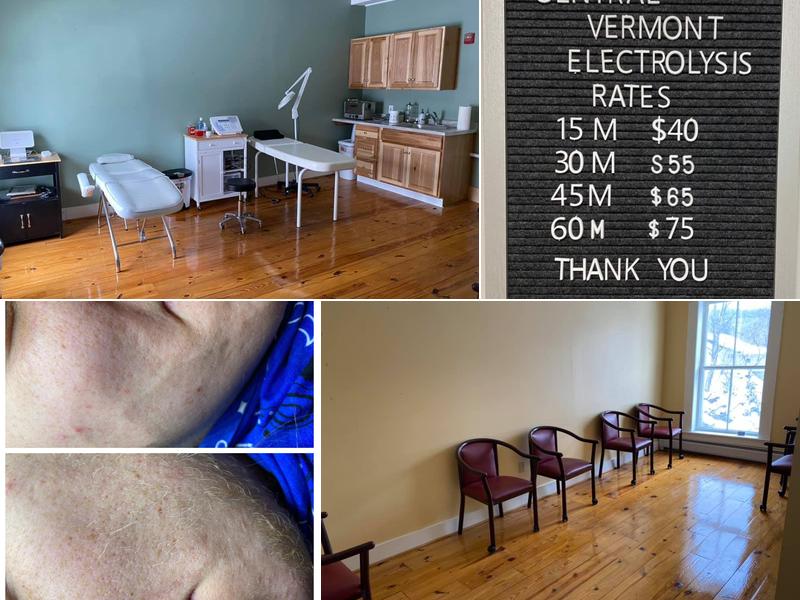 Central Vermont Electrolysis