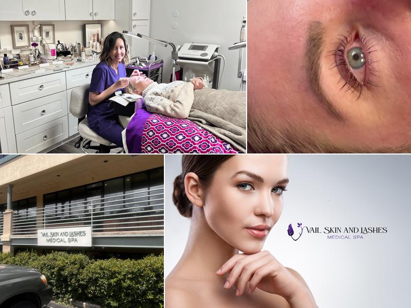 Vail Skin and Lashes Medical Spa