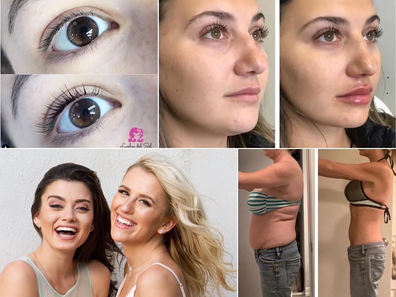 Lashes Del Sol - ReKindle Beauty and Aesthetics