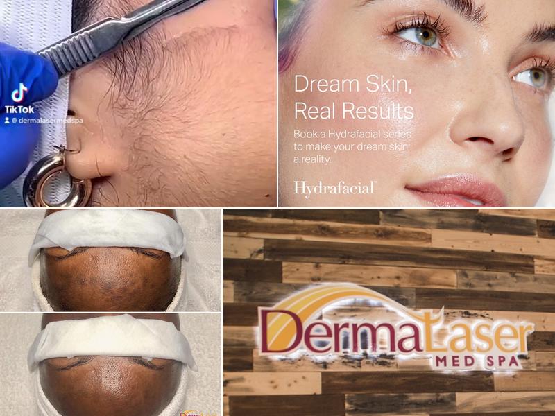 Dermalaser Med Spa