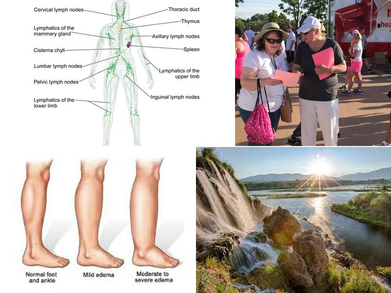 ABC Lymphedema Clinic