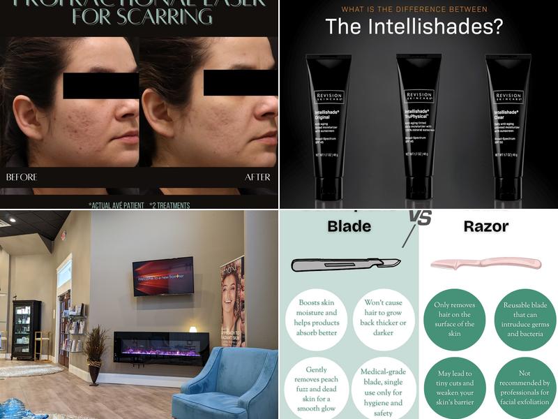 Ave Medical Laser Spa