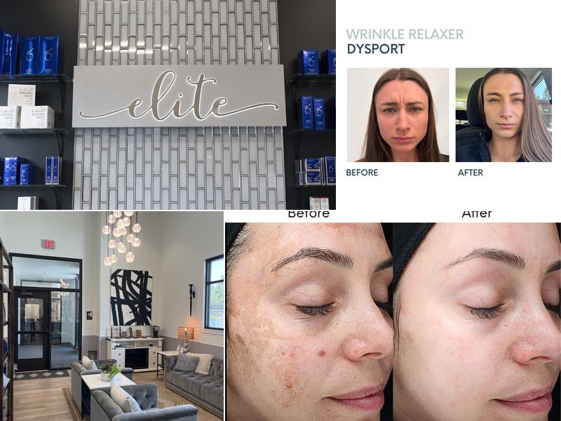 Elite Medi Spa