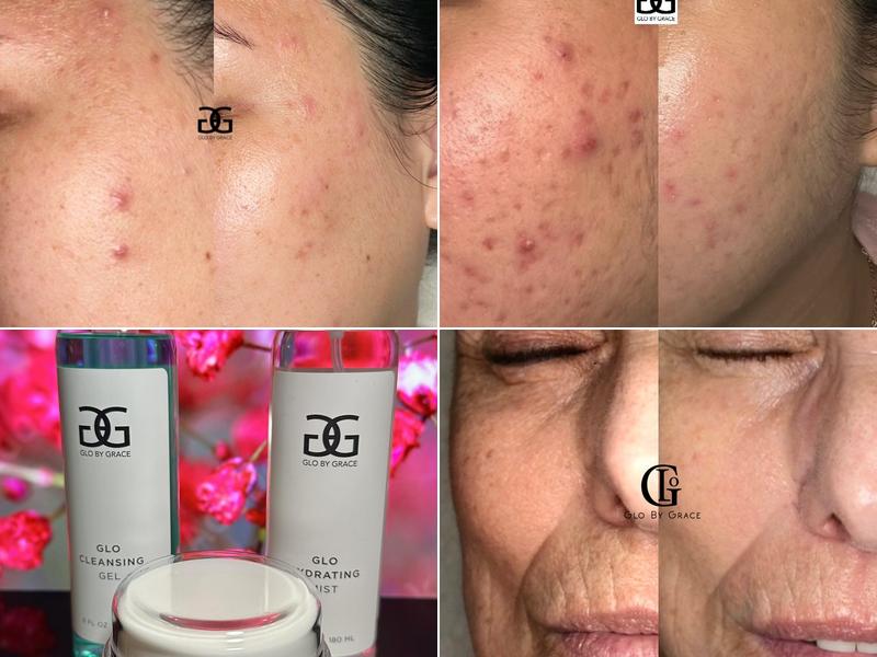 GLO BY GRACE SKIN CARE STUDIO