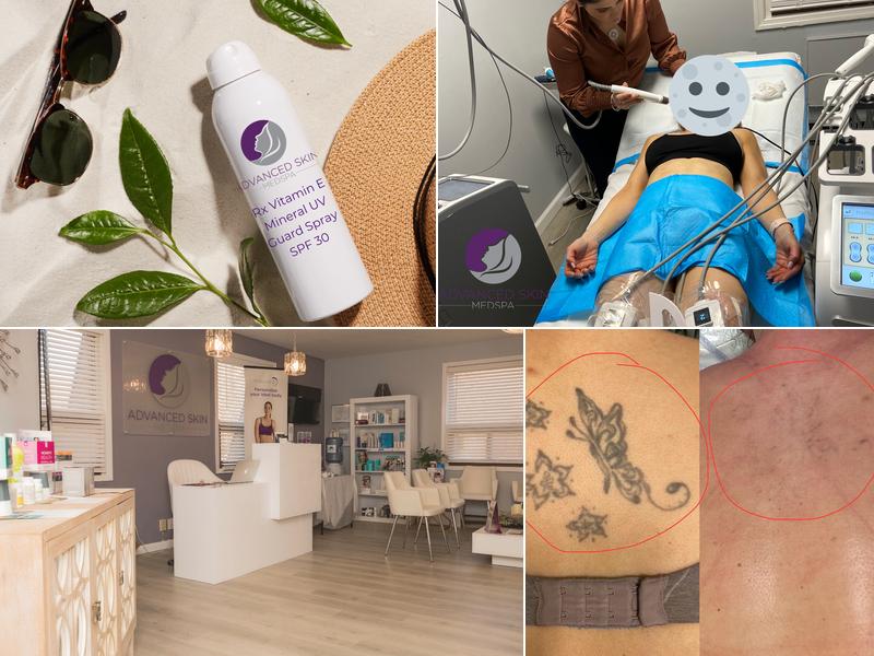 Advanced Skin Medspa