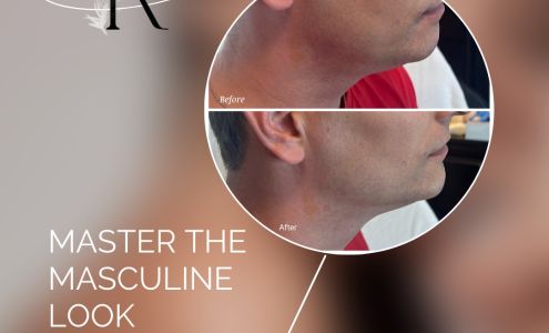 Inner Radiance Medical Spa 301 Keller Ave, Fayetteville West Virginia 25840