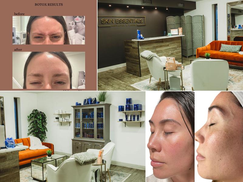 Skin Essentials Med Spa