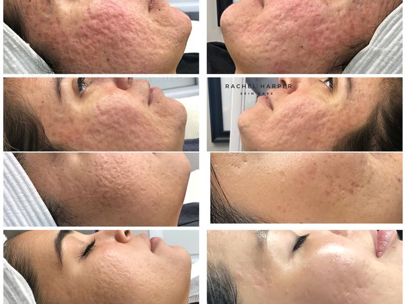 Rachel Harper Skincare