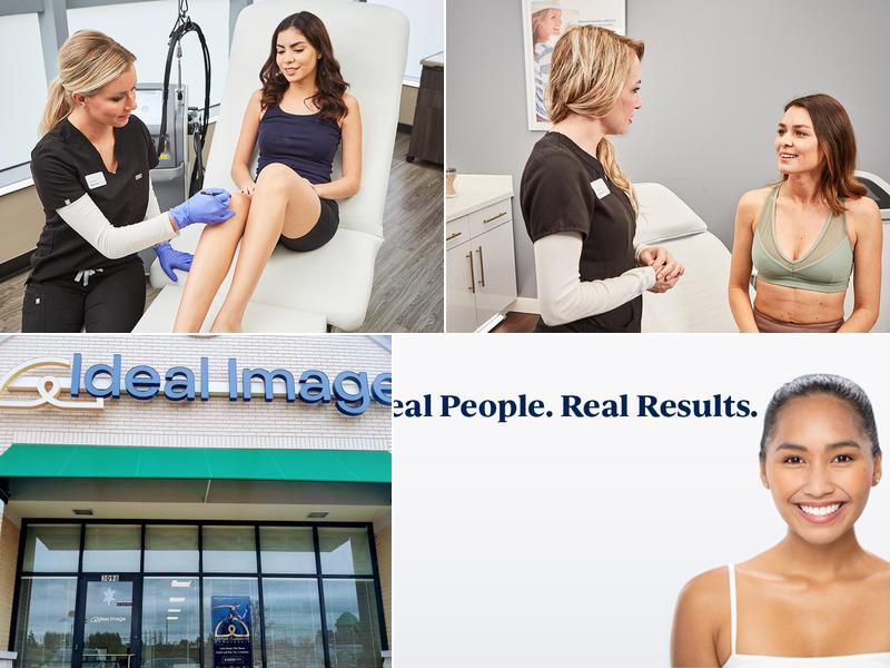 Ideal Image O'Fallon