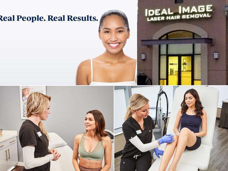 Ideal Image Westminster