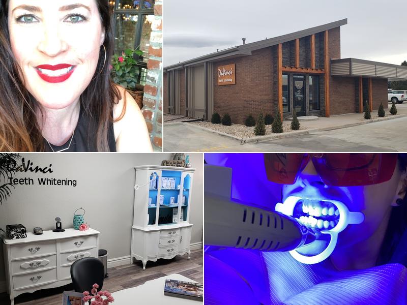 Davinci Teeth Whitening