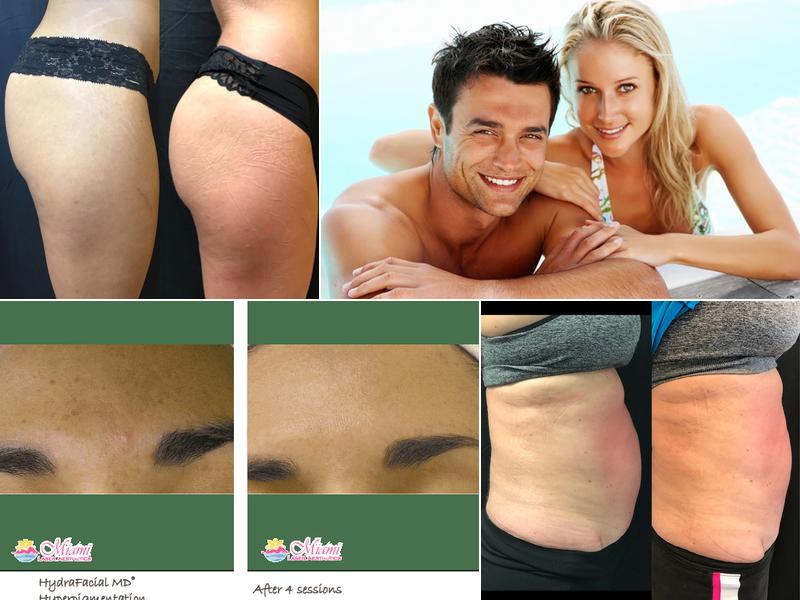 Miami Body Aesthetics