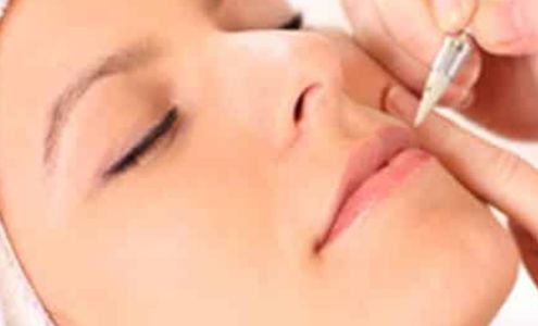 Electrolysis By Debra