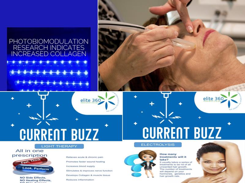 Elite 360 (Electrolysis)