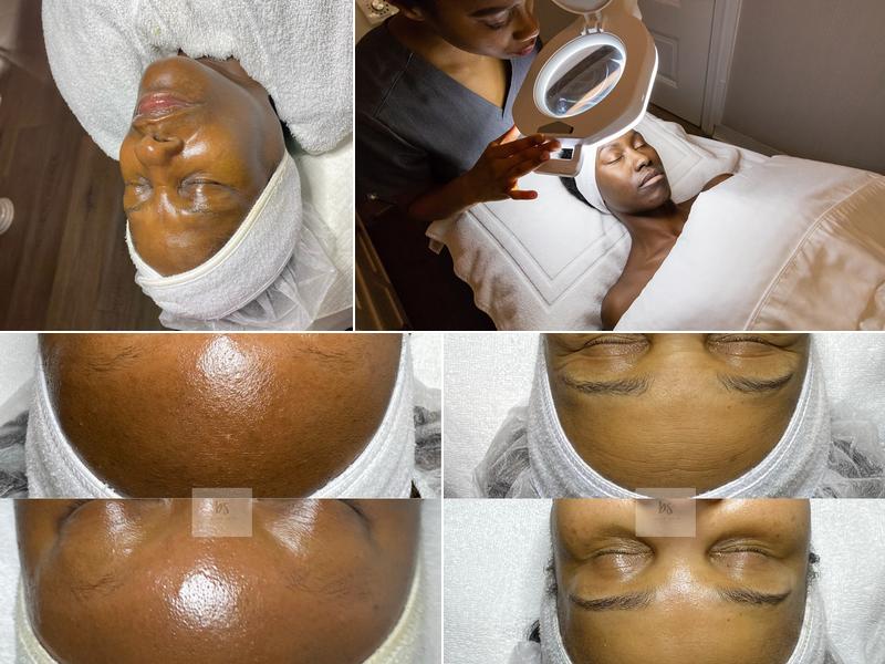 Bare Skin Facial and Waxing Studio