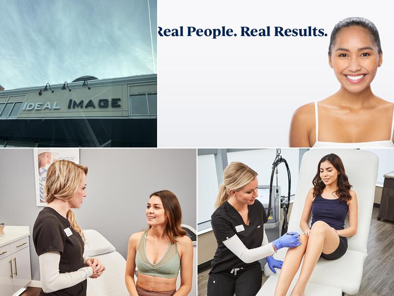 Ideal Image North Andover