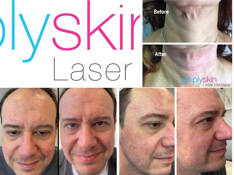 Simply Skin Laser Medispa