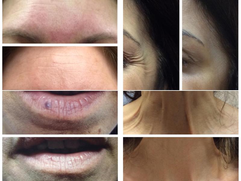 Dr. Phyllis J. Smith, MD