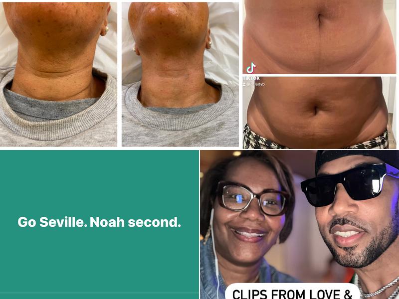 Skin Esteem by B. Beckford, Nurse Practitioner