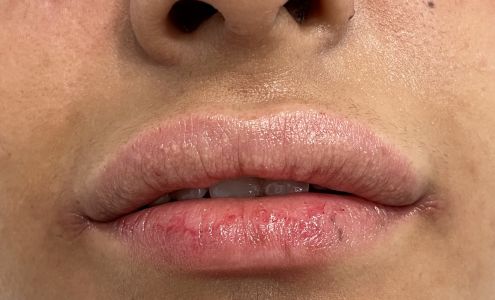 Hoboken Cosmetic & Laser Center