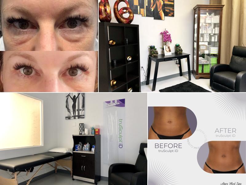 Apex Medical Spa