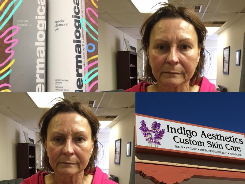 Indigo Aesthetics Custom Skin Care