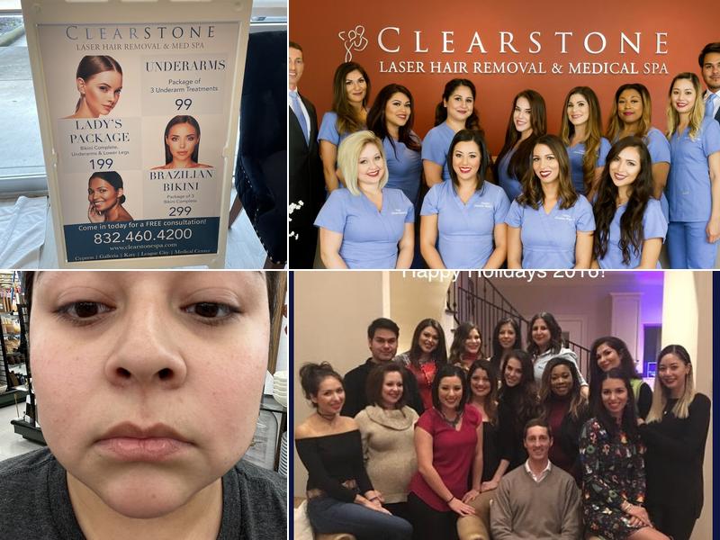 Clearstone Laser Hair Removal