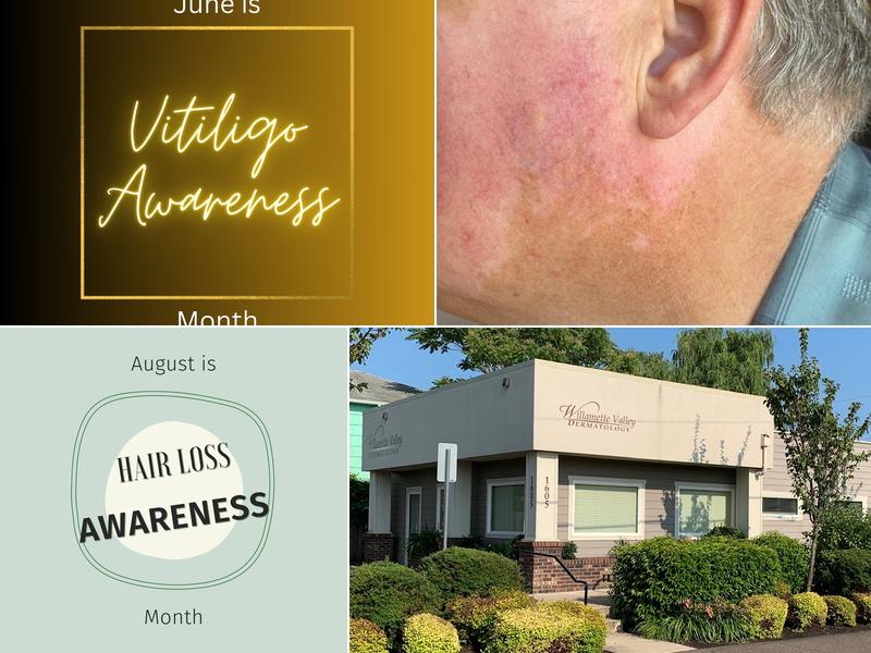 Willamette Valley Dermatology