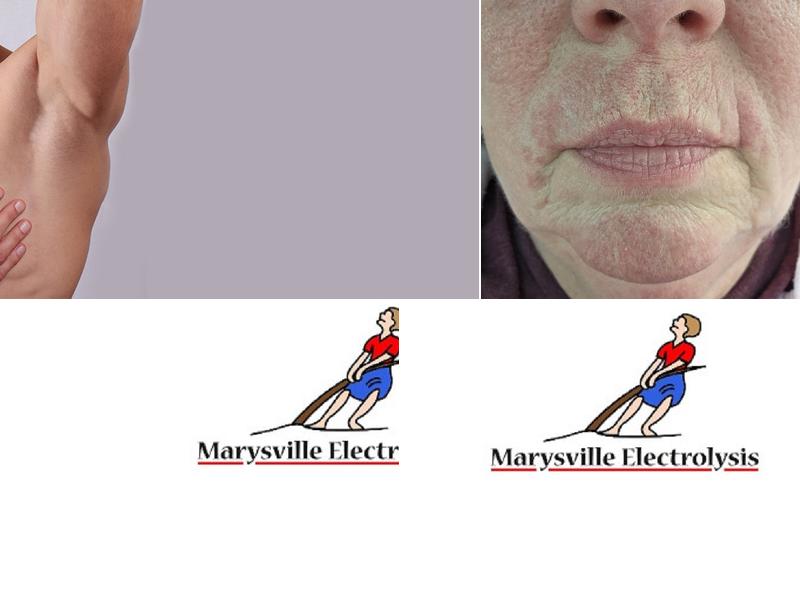 Marysville Electrolysis
