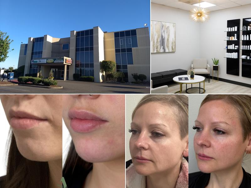 Advanced Skin Therapy of Smokey Point