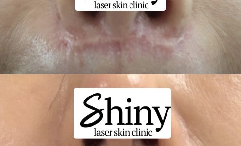 Shiny Laser Skin Clinic