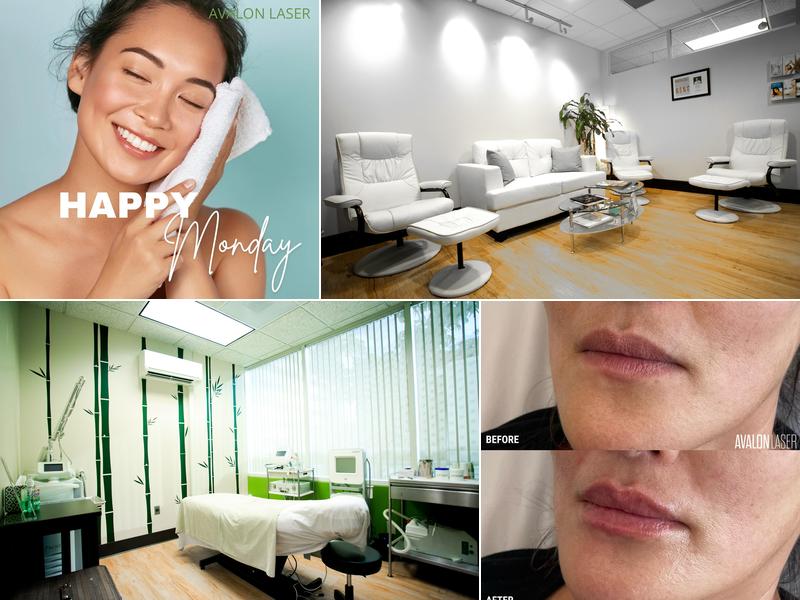 Avalon Laser | Dr. Reza H. Tirgari