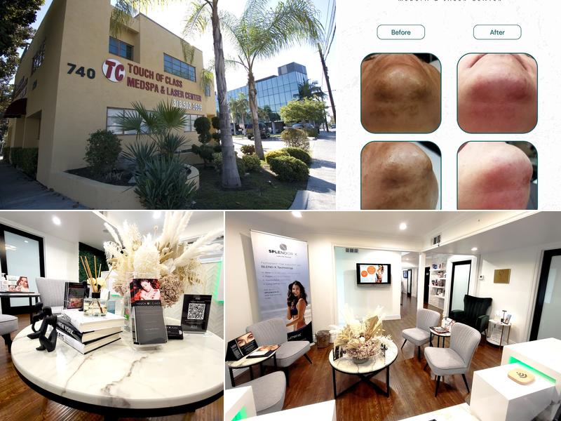Touch Of Class Medspa and Laser Center